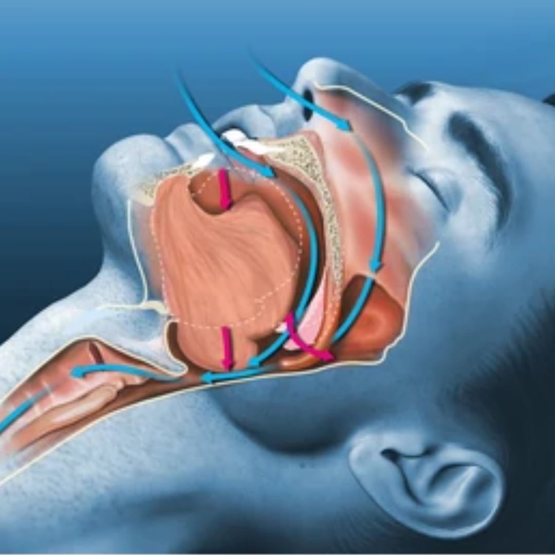 Sleep Apnea & Respiratory Wellness
